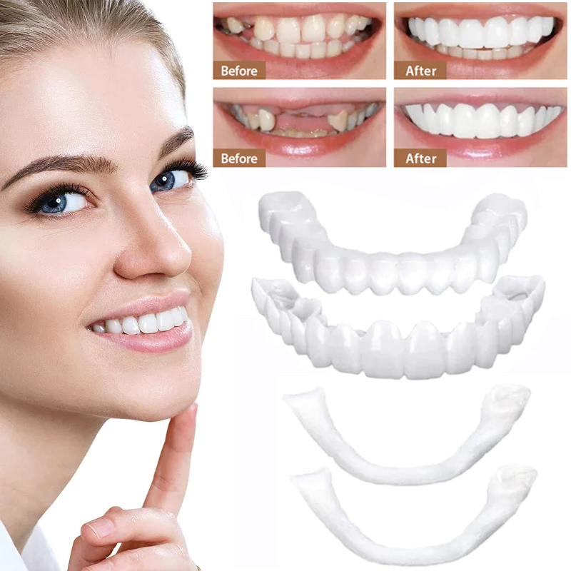 Comfortable Clip-On Veneers | Natural White Composite Finish 2