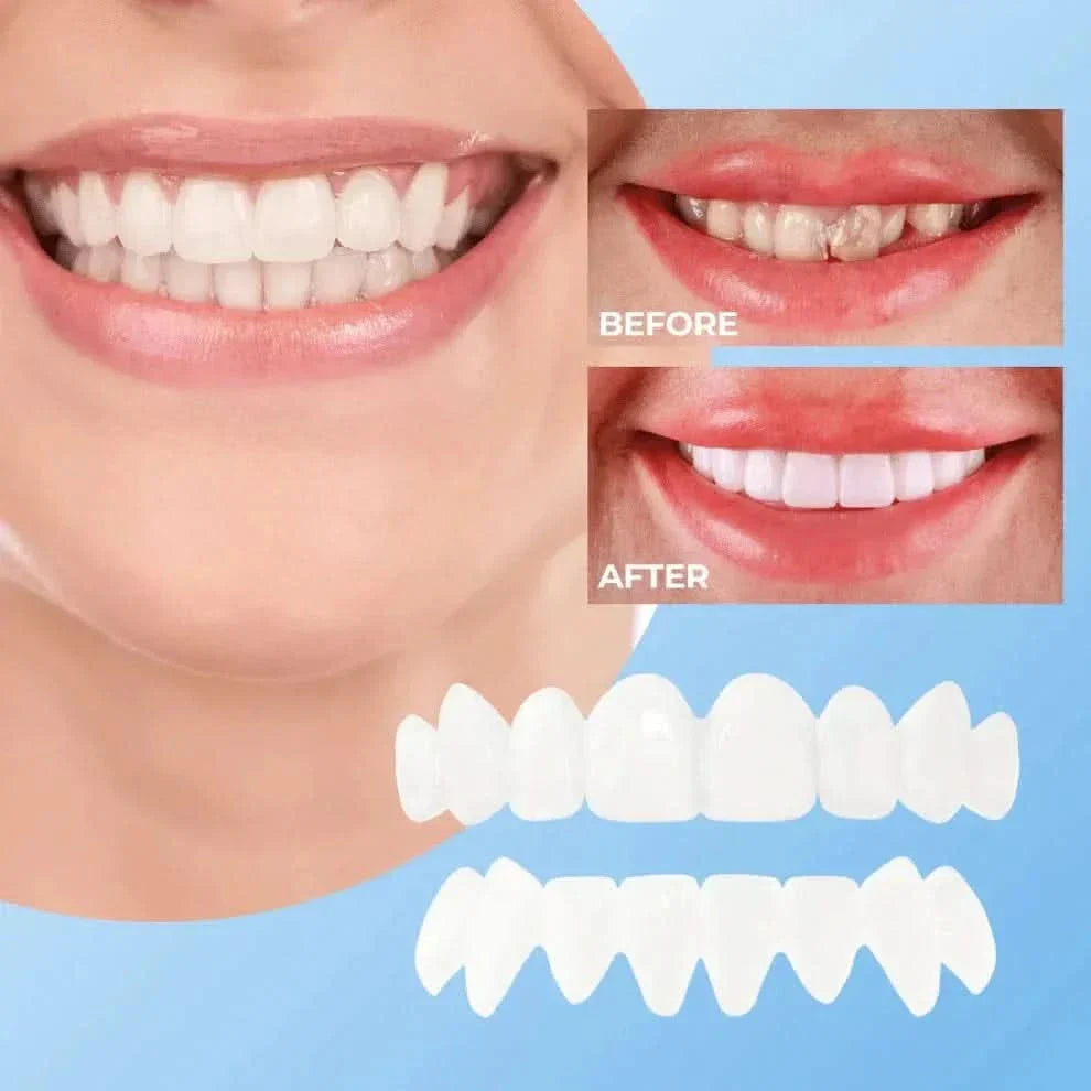 Comfortable Clip-On Veneers | Natural White Composite Finish 3