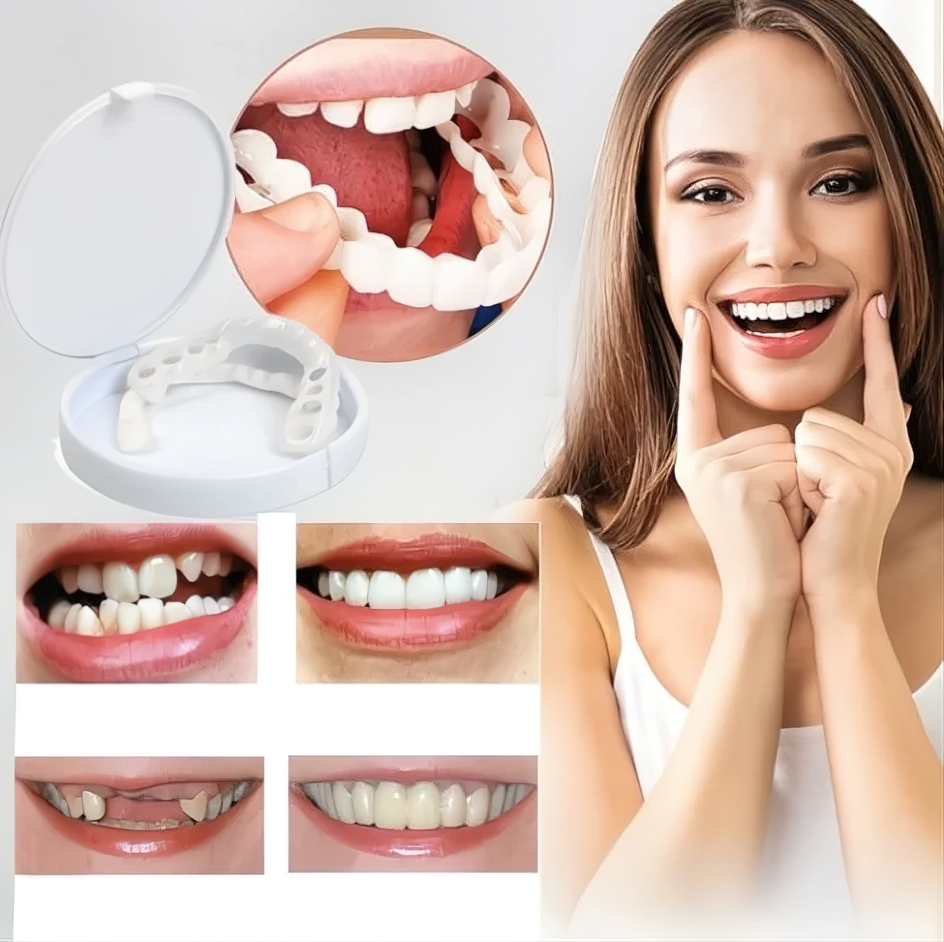 Comfortable Clip-On Veneers | Natural White Composite Finish 6