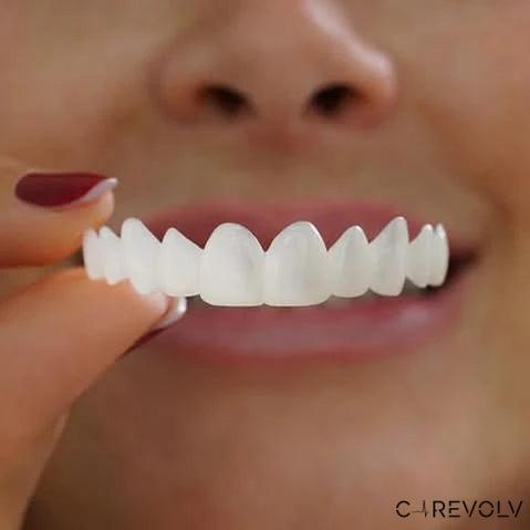 Comfortable Clip-On Veneers | Natural White Composite Finish 0