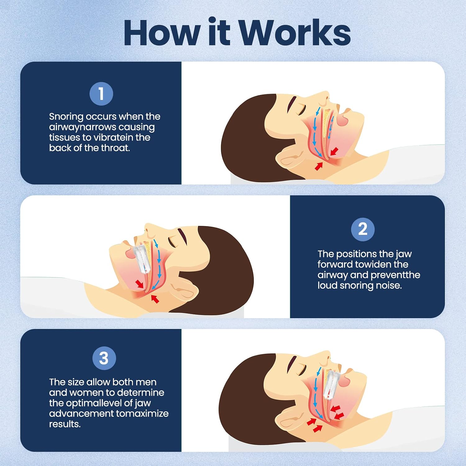 Snoring Sleep Aid Mouthpiece Comfortable Sleep Relief
