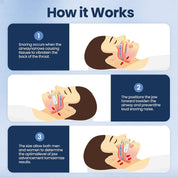 Snoring Sleep Aid Mouthpiece Comfortable Sleep Relief