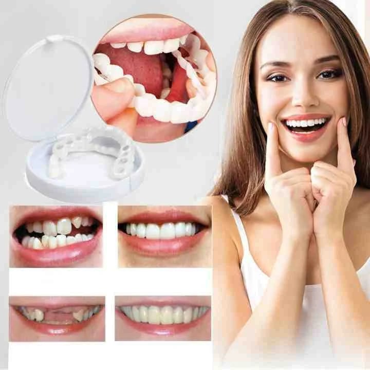 Instant Veneers Missing Teeth Natural-Looking Dental - Image 1