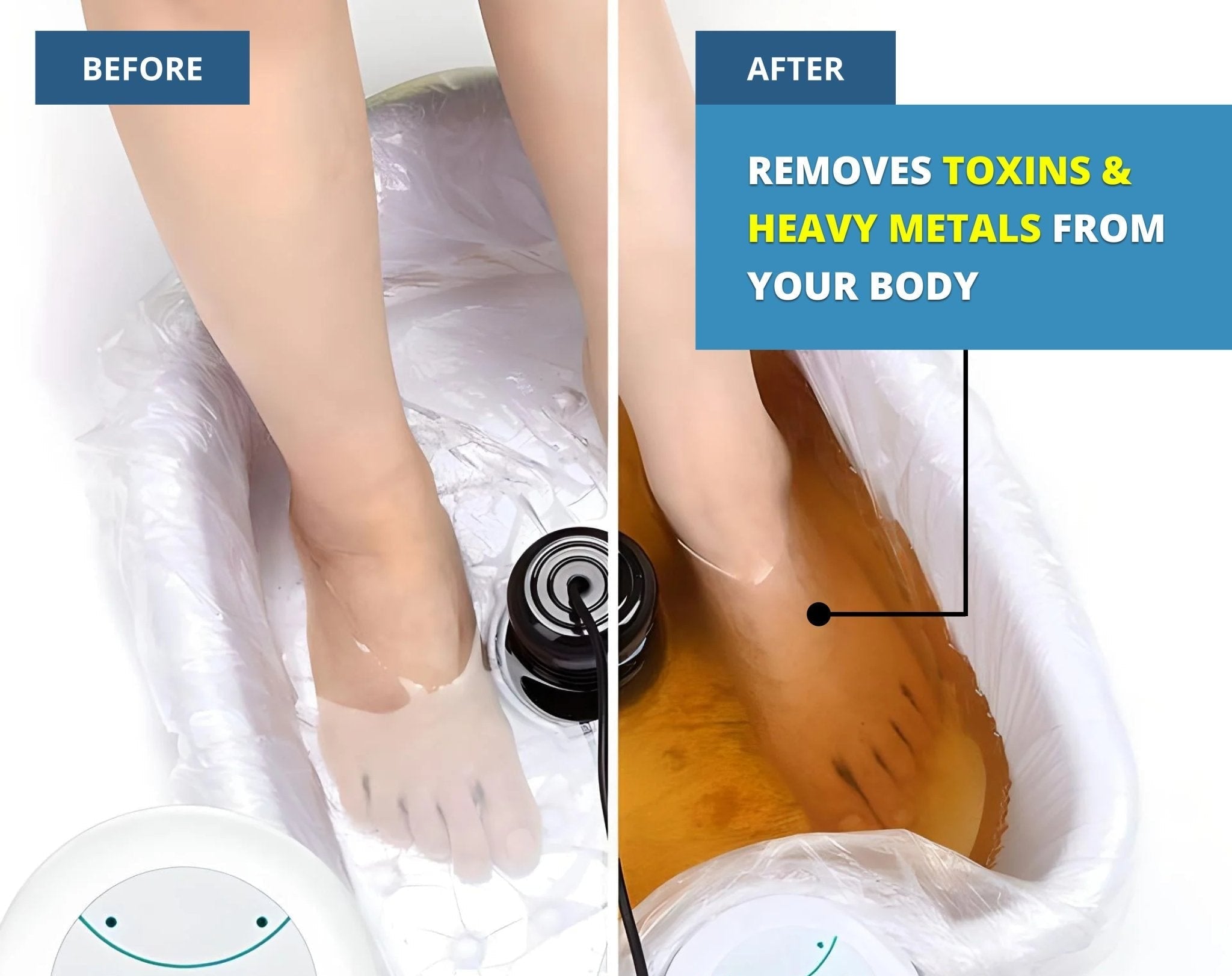 Ionic Detox Foot Bath Toxin Removal Professional Health Care Device - Image 5