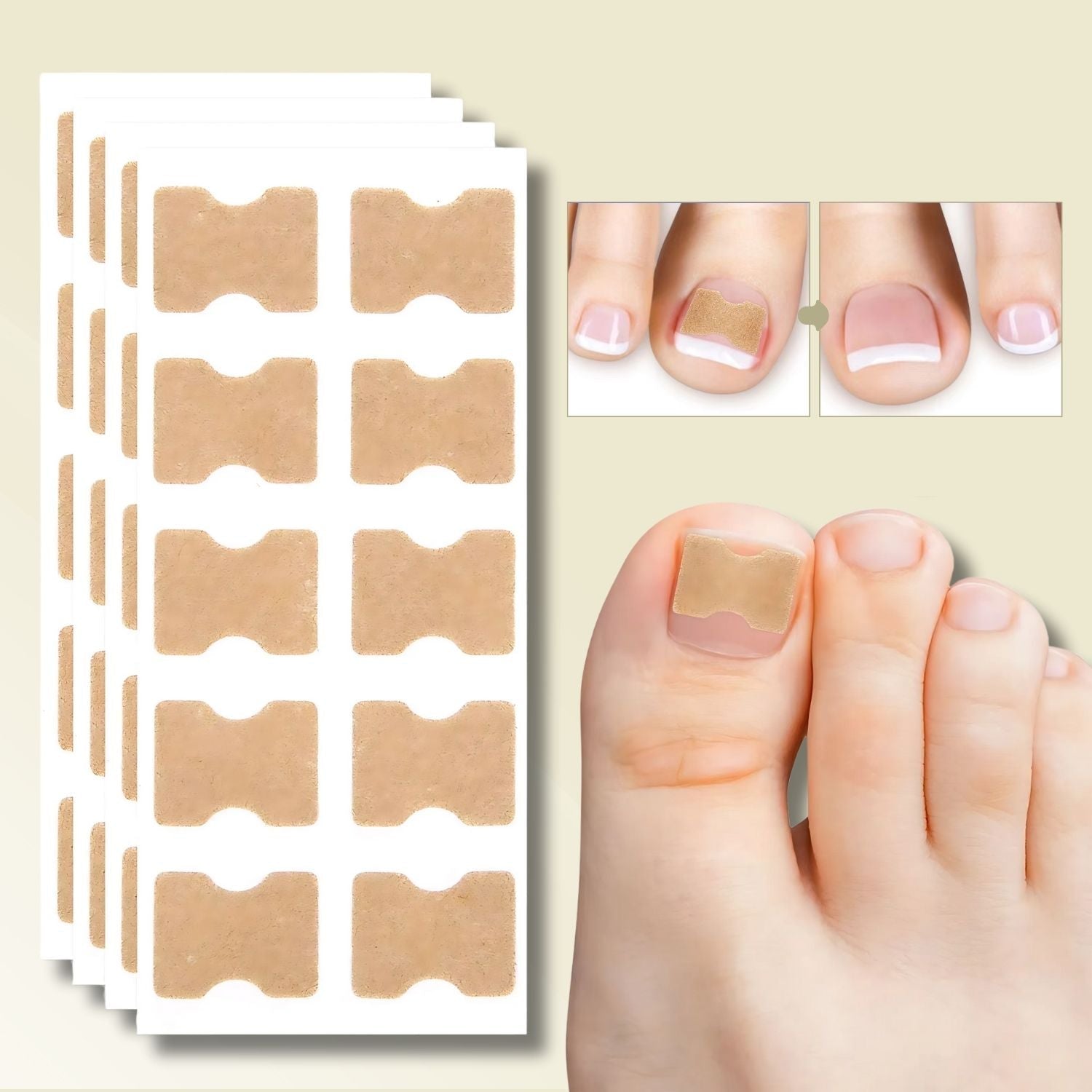 Nail Repair Patches Ingrown Toenails Treatment - Image 1