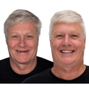 Natural-Looking Dentures Comfort and Confidence Smiling - Image 10