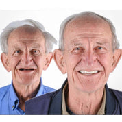 Natural-Looking Dentures Comfort and Confidence Smiling - Image 11