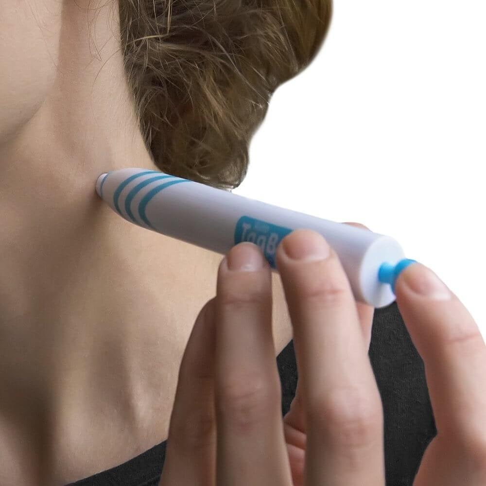Skin Tag Removal Kit Easy Use Beauty Tool Home Treatment - Image 2
