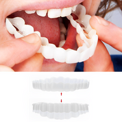 Smile Veneer Teeth Cover Set Instant Smile Makeover Home - Image 1