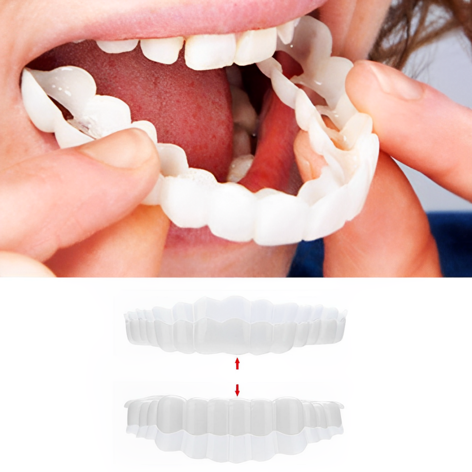 Smile Veneer Teeth Cover Set Instant Smile Makeover Home - Image 1
