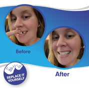 Smile Veneer Teeth Cover Set Instant Smile Makeover Home - Image 3