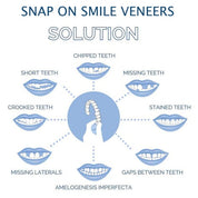 Smile Veneer Teeth Cover Set Instant Smile Makeover Home - Image 6