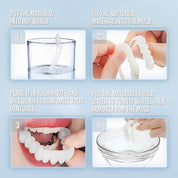 Smile Veneer Teeth Cover Set Instant Smile Makeover Home - Image 7