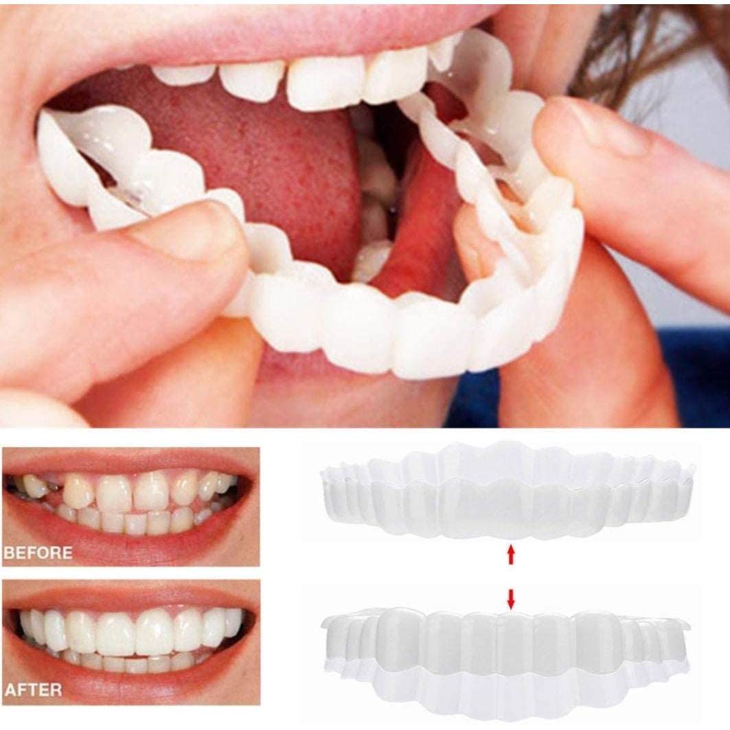 Smile Veneer Teeth Cover Set Instant Smile Makeover Home - Image 9