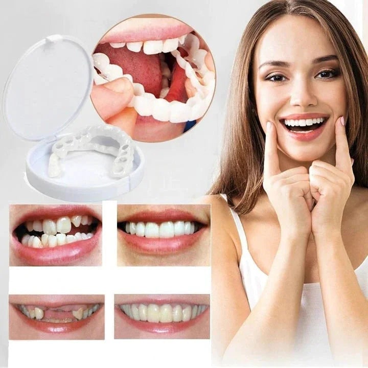 Snap-On Teeth Veneers Smile Correction and Dental Aesthetics - Image 2