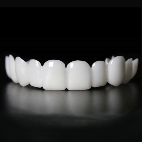 Snap-On Teeth Veneers Smile Correction and Dental Aesthetics - Image 3