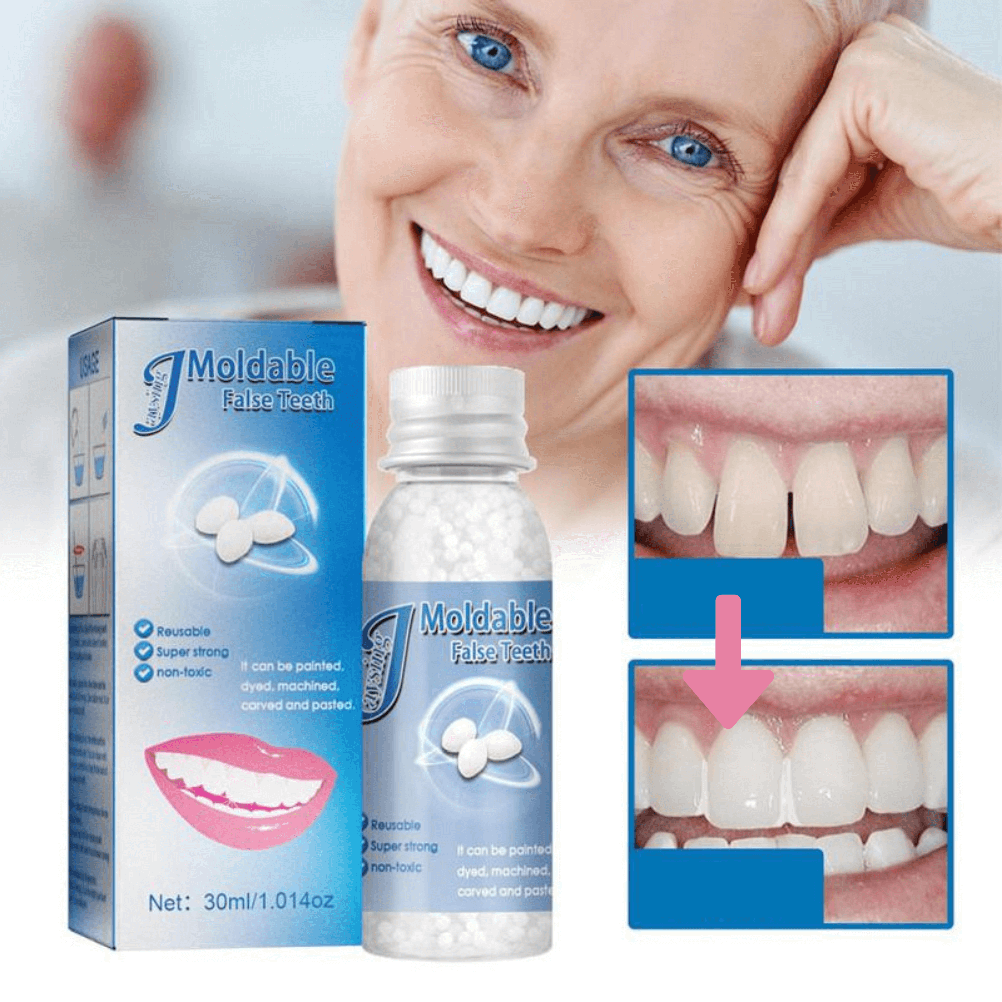 Temporary Tooth Filling Kit Dental Repair Moldable & Easy Use - Image 1