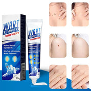 Wart Remover Ointment Skin Tags and Warts Fast Acting Treatment - Image 2